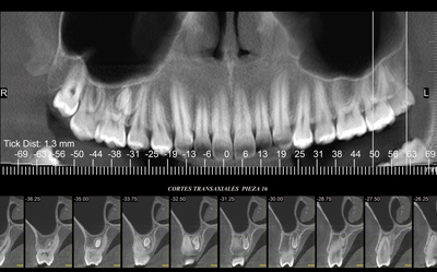 Localización Dentaria